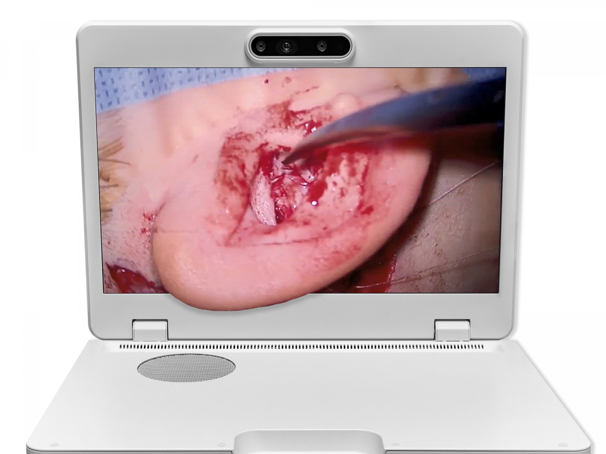 达擎之＂Heads-up 3D显微手术显示系统＂，整合4K裸眼3D显示及眼球追踪系统，具备快速追踪人眼移动位置功能，减轻医师长时间维持固定姿势的负担，让医师能有更宽广清晰的3D立体视野及更舒适的姿势来执行手术。